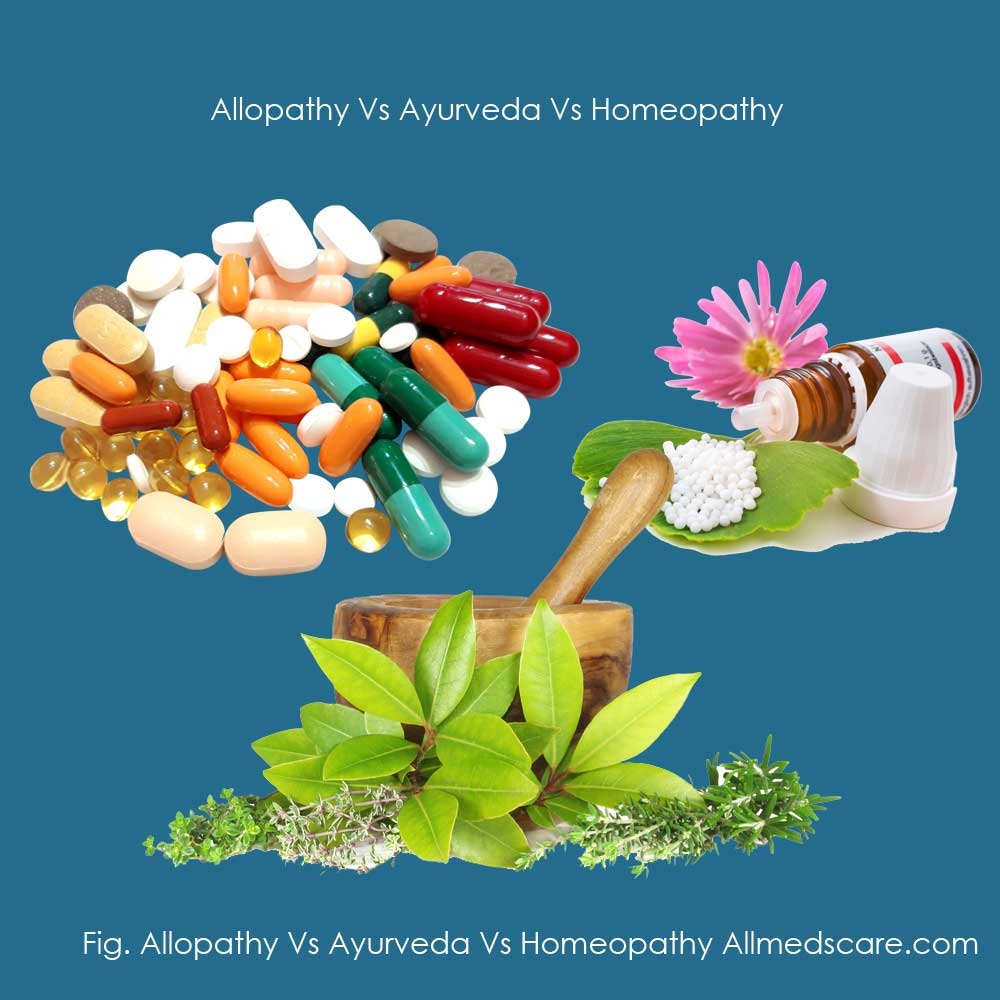 Ayurveda, Allopathy, Homeopathy, and Unani Treatment Methods